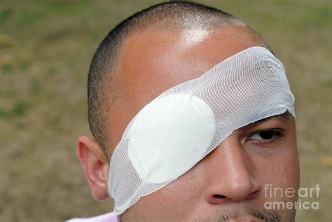 Man Wearing Any Eye Patch Photograph By Medicimage Science Photo