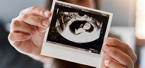 ssw 14 ultraschall untersuchung in schwangerschaft