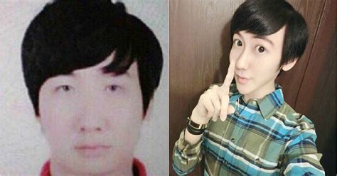 Lelaki 18 Tahun Di China Ini Buat Pembedahan Plastik Kemudian Hina