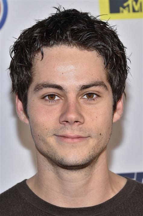 All Natural And More Dylan Obriens Injuries Force Maze Runner