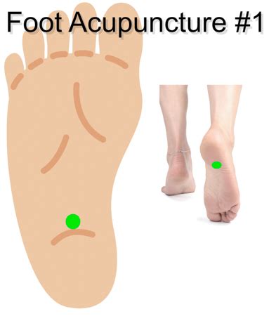 Plantar fasciitis occurs when the plantar fascia becomes inflamed or irritated, resulting in a sharp or dull pain felt at the bottom of the heel.﻿﻿ Acupuncture Plantar Fasciitis Relief Confirmed
