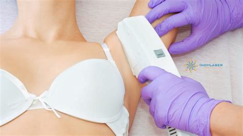 What's the real price you'd pay for smooth skin? Armpit Laser Hair Removal: Cost, Information, and ...