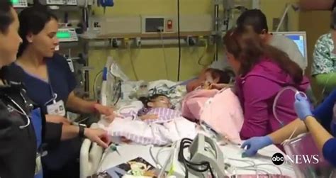 Separated Conjoined Twin Sisters Meet For First Time Videos Metatube