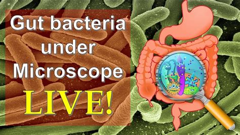 Bacteria, disease, escherichia coli, pathogens, microscopy. Gut bacteria Escherichia coli under microscope! - YouTube