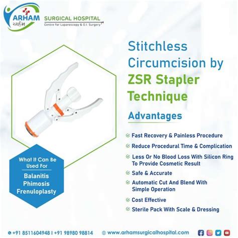 ZSR Circumcision A Safer Stitchless Quicker Circumcision Procedure