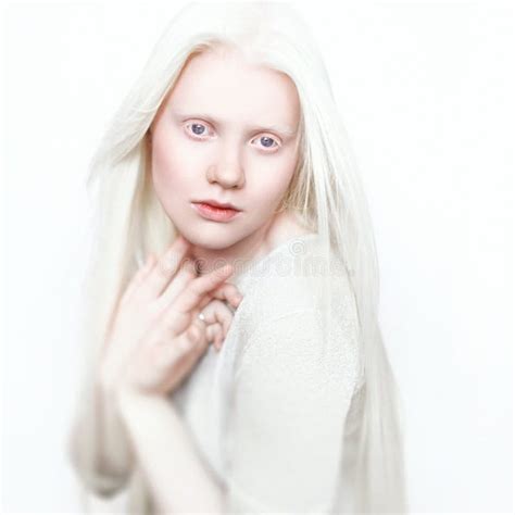 Albino Woman With White Pure Skin And White Hair Photo Face On A Light Background Portrait Of