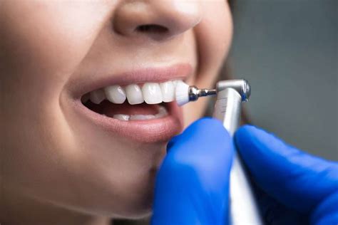 Dental Deep Cleaning Vs Regular Cleaning Whats The Difference