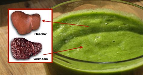 This Fatty Liver Cleanse Will Reset Your Metabolism And Jumpstart Your