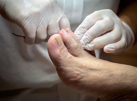 Diabetes Foot Care And Guidelines For Healthy Feet Sanders Podiatry