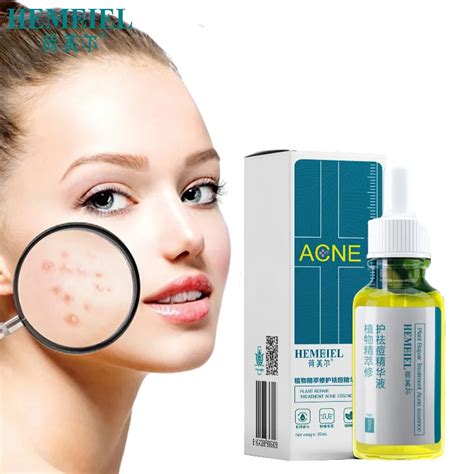 Hemeiel Herbal Plant Acne Treatment Face Serum Oil Control Moisturizing