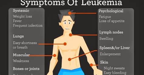 Understanding And Recognizing Leukemia Symptoms
