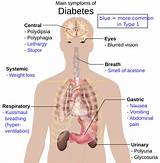 Pictures of What Doctor Do You See For Diabetes