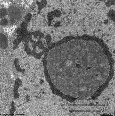 Liver Drjastrows Electron Microscopic Atlas