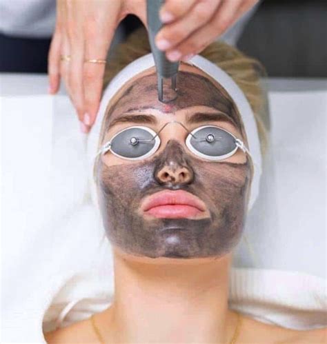 Laser Carbon Facial For Radiant Skin Rejuvenation Immersion Clinics