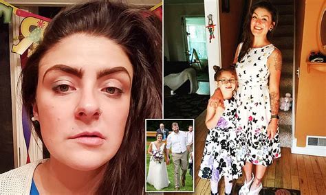 Mother Left Unable To Eat Or Blink For Five Weeks After Stress Triggered Total Facial Paralysis