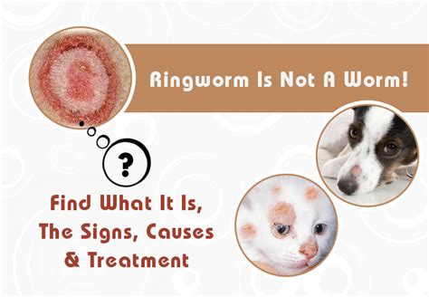 Ringworm Is Not A Worm Find What It Is The Signs Causes And Treatment
