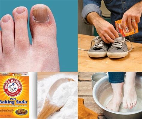 Baking Soda For Toenail Fungus Care Tips For Toenail Fungus ⋆ Helth