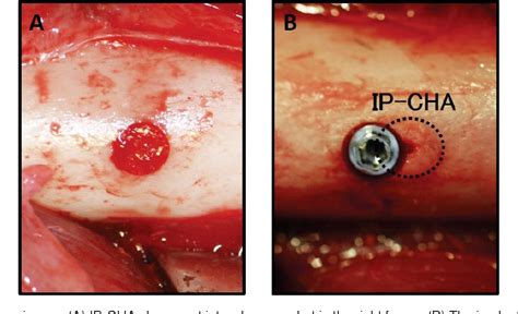 Figure 3 From Osseointegration Aspects Of Placed Implant In Bone