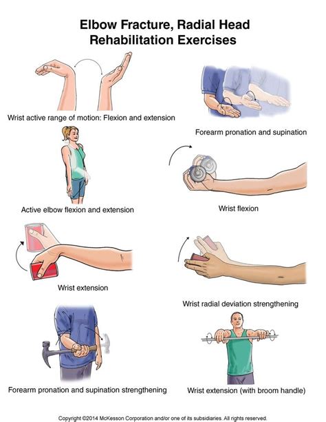 Summit Medical Group Elbow Fracture Radial Head Exercises Humerus