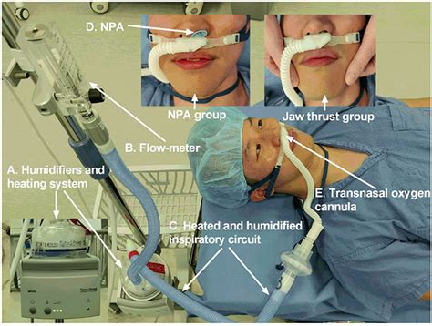 Frontiers Transnasal Humidified Rapid Insufflation Ventilatory