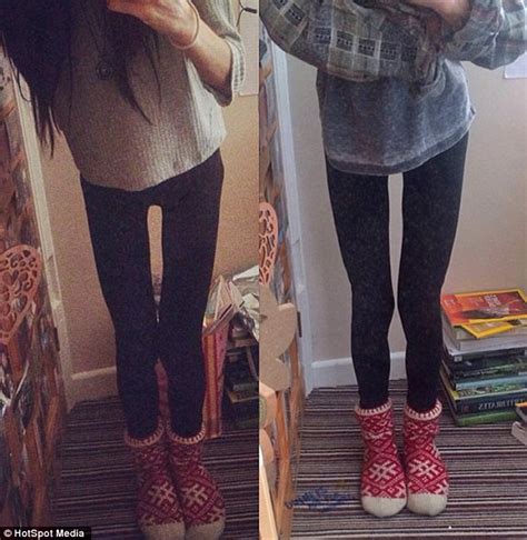 Graduate Obsessed With Getting A Thigh Gap Exercised For Three Hours