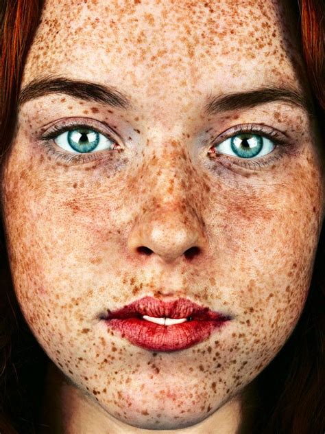 These Stunning Portraits Show The True Beauty Of Freckles