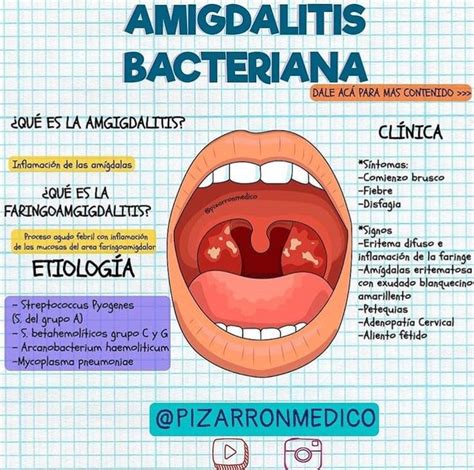 Amigdalitis Bacteriana Good Doctor Medicine Anatomy