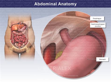 abdominal anatomy gastroesophageal junction trial exhibits inc