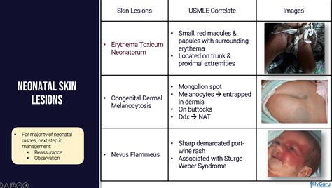 High Yield Nbme Images Pediatrics Neonatal Skin Lesions Step 2 Ck