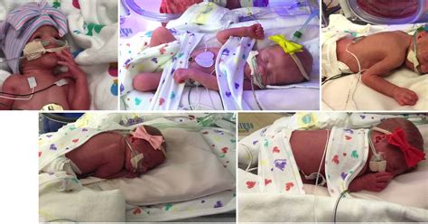 Thriving First All Girl Quintuplets In Us Are Born In Texas