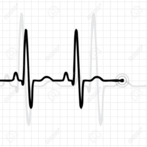 Flatline Ekg Cliparts Free Download On Clipartmag