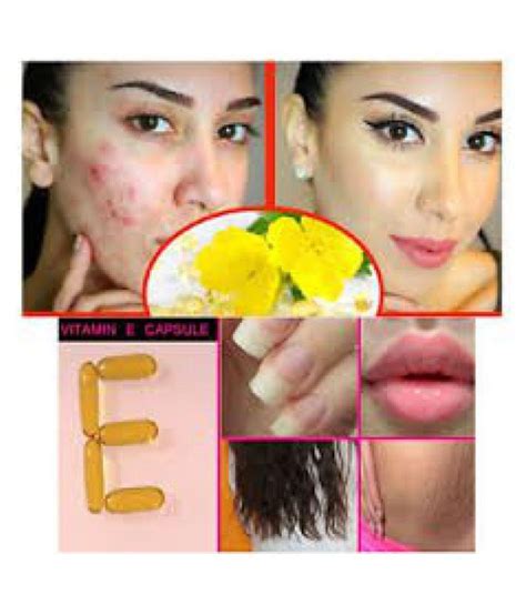 Patients often wish to apply vitamin e for scars. Vitamin E for skin, hair, Scars, Acne,Dark Spots, under ...
