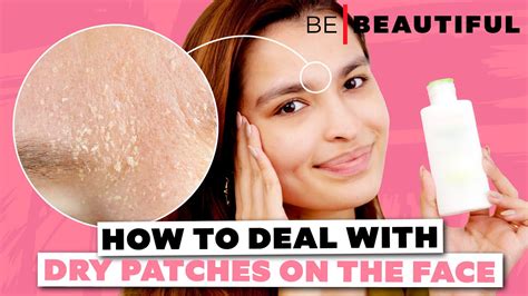 How To Remove Dry Patches From Your Face Tips To Deal With Dry Skin