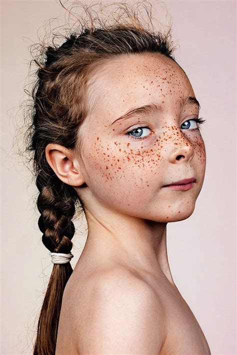 These Portraits Celebrate The Joy Of Having Freckles Freckles Portrait Interesting Faces
