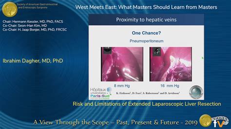 Risk And Limitations Of Extended Laparoscopic Liver Resection Youtube
