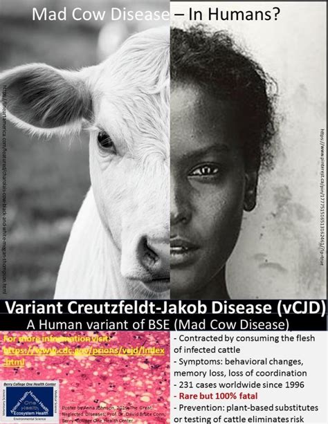 Mad Cow Disease In Humans