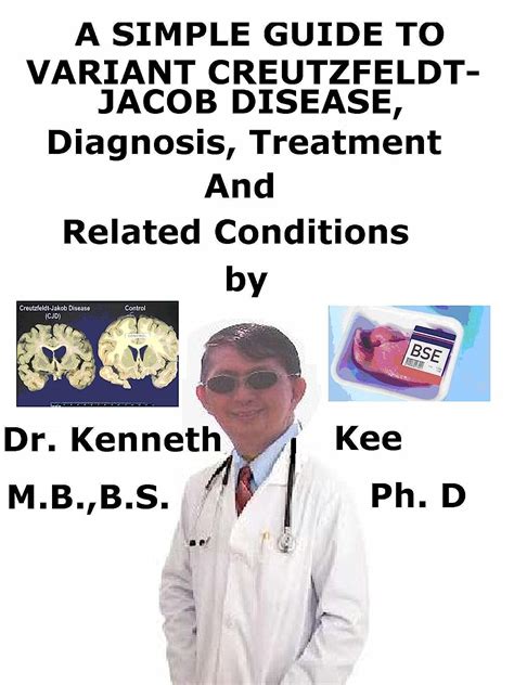 A Simple Guide To Variant Creutzfeldt Jakob Disease Diagnosis