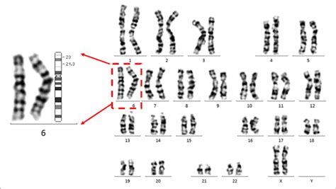The Proband Carries A Chromosomal Inversion In Chromosome