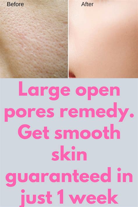 Large Open Pores Remedy Get Smooth Skin Guaranteed In Just 1 Week Most