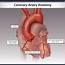 Coronary Artery Anatomy  TrialExhibits Inc