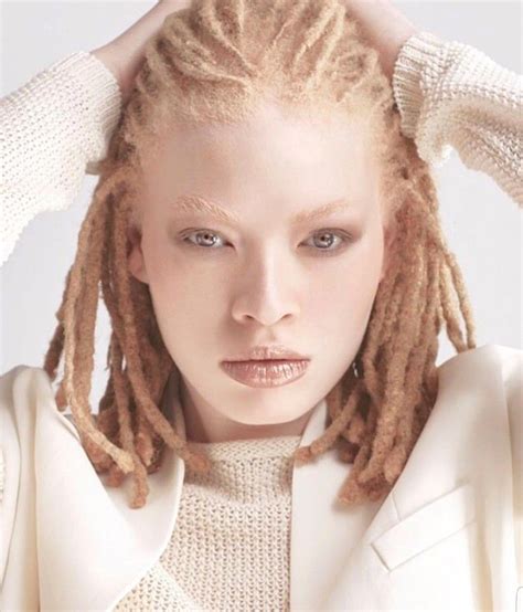 Pin By Medina Jones On Knotty Girls Albino Model Dreads Girl Albino