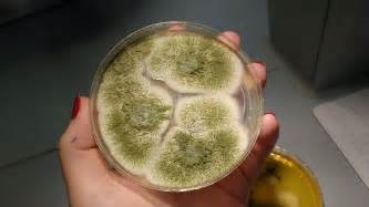 Aspergillus Fumigatus Sabouraud Agar Plate Microbiology Fungi