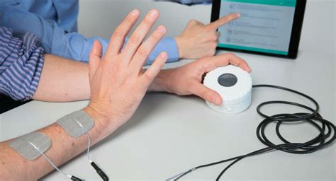 Stroke Patients Regain Arm Mobility With Self Administered Shocks