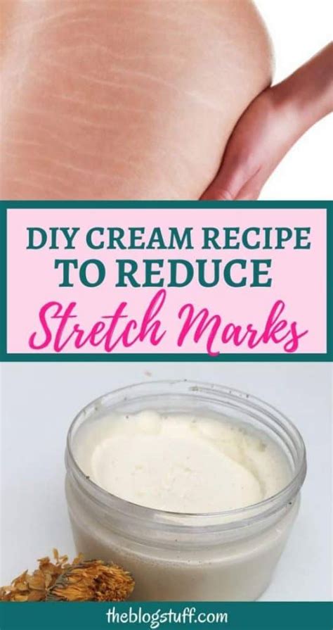 Homemade Stretch Marks Cream With Vitamin E And Calendula Oil