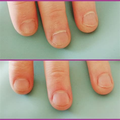 Cuticle Care Is So Satisfying Before And After Rnails