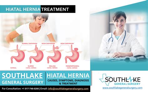 Hiatal Hernia Treatment At Southlake General Surgery Texas Southlake