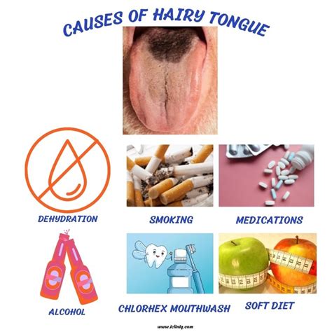 Black Hairy Tongue Causes Symptoms And Treatment