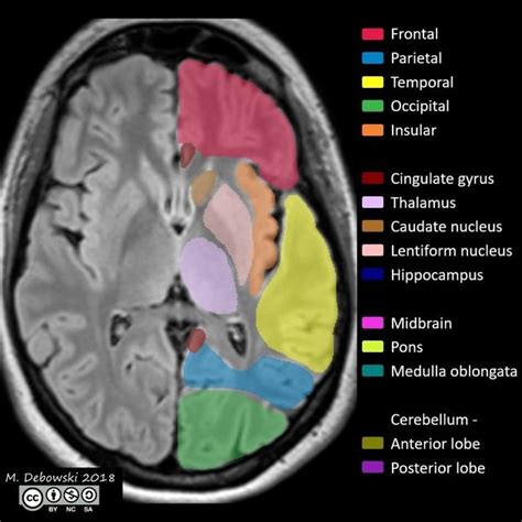 A class discussing the basics of the ct brain examination. Neuroanatomy | Radiology Reference Article | Radiopaedia ...