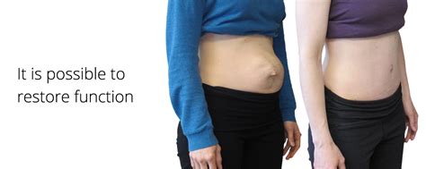 Diastasis Rectus Abdominis Baby Belly Pelvic Support By Diane Lee