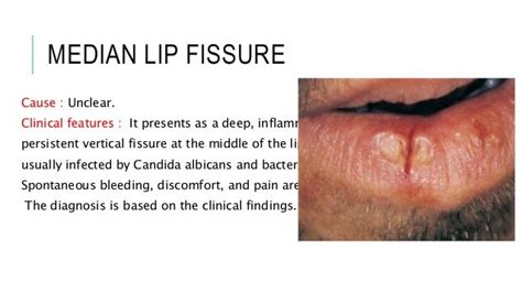 Lip Lesion Oral Medicine